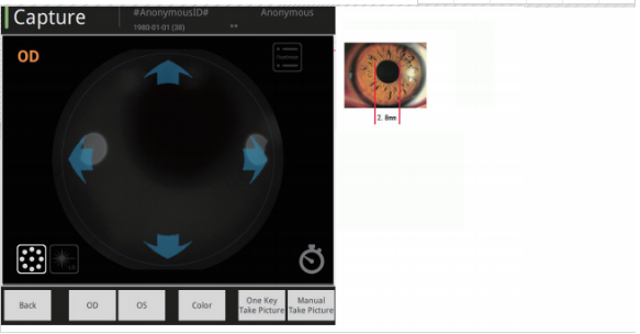Wide Field Non Mydriatic Fundus Camera 2.8mm Pupil Imaging 135° Field Of View