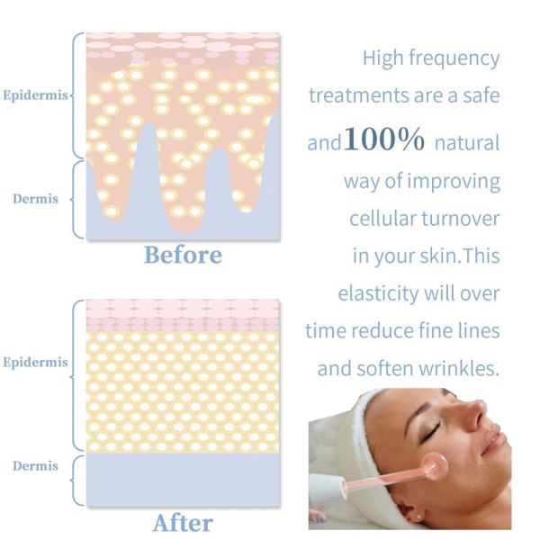 ODM Multifunctional Facial Machine Salon High Frequency Skin Therapy Machine
