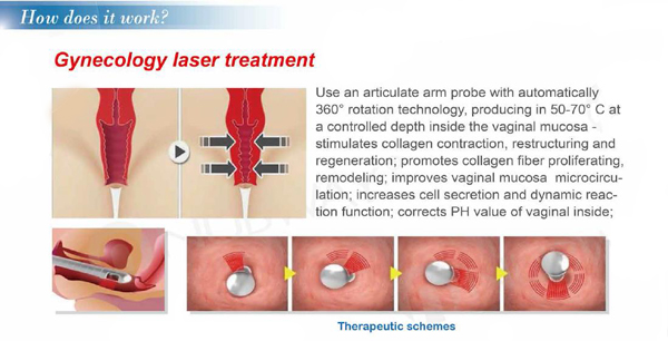Mutiple patterns,strong laser generator,latest practical design,Forimi Fractional CO2 Laser Machine