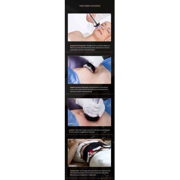 AS86 Portable 80K Cavitation Rf Vacuum Slimming Machine Body Shaping
