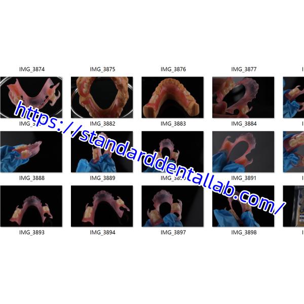 High Esthetics Dental TCS Valplast Flexible Partial Dentures Dental Lab pink shade