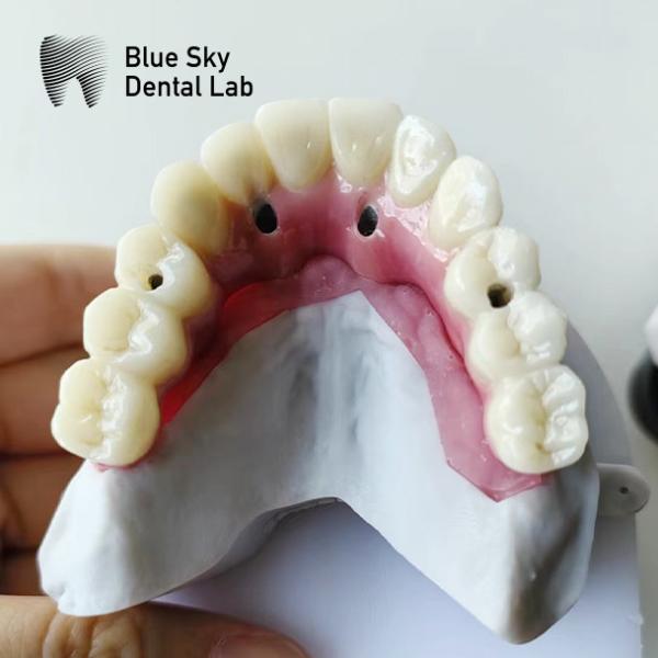 Nature Implant Procedure Cases with Universal Compatibility and Optimal Performance