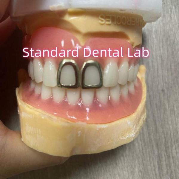 ISO Full Acrylic Dentures With Yellow Gold Teeth Open Face
