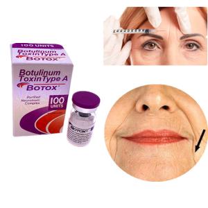 China 100 Unit Allergan Botulinum Toxin Type A For Face And Eyes Removal Rrinkles on sale