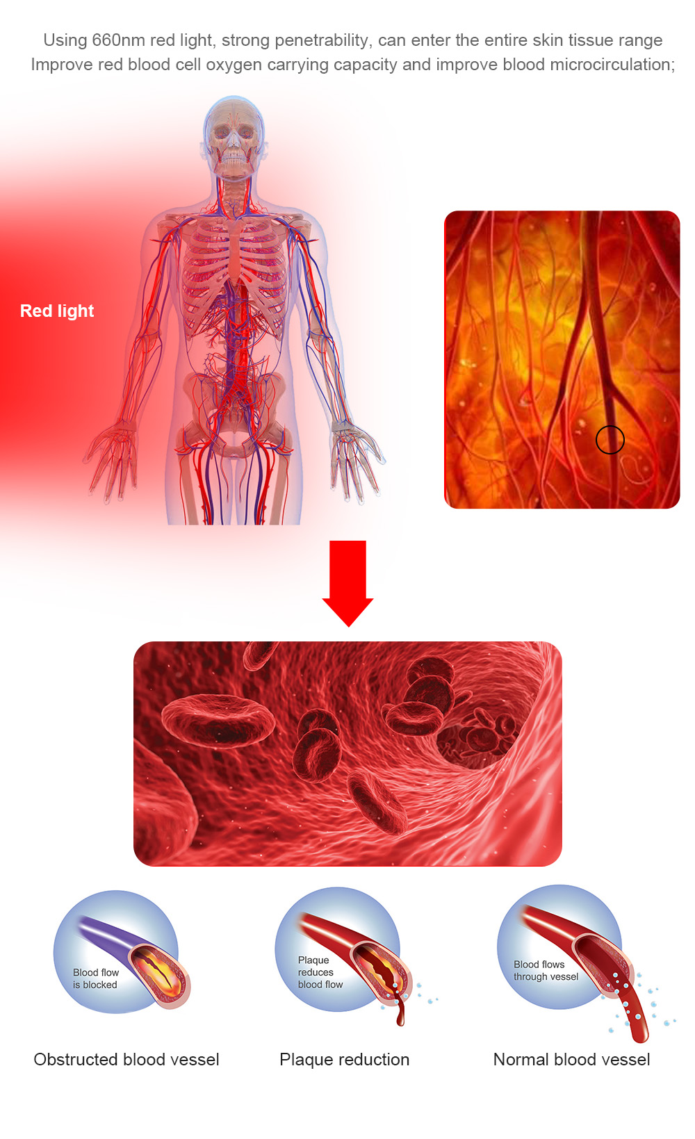 Improves Blood Circulation Relieves Joint Pain Light Therapy Machine Near Infrared Therapy Mat