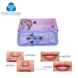 China Facial Wrinkle Ha Gel Dermal Filler Injectable Hyaluronic Acid Filler For Lips on sale