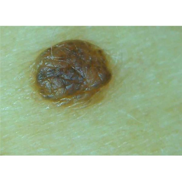 Wireless Digital Microscope Dermatoscope Skin And Hair Scanner For Android And IOS Software