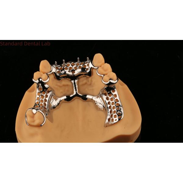 Upper Cast Framework Acrylic Metal Partial Dentures Strong Lightweight and Durable