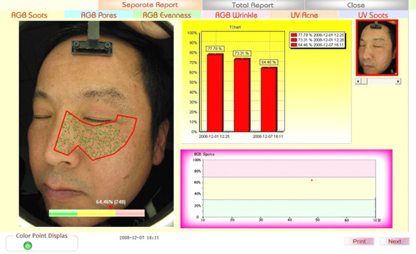 Hot sale intelligent skin analyzer machine with high resolution