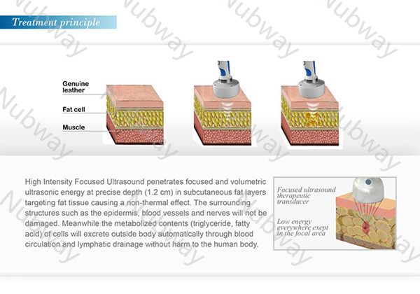 HIFU slimming machine no side effect ultrasonic slimming machine